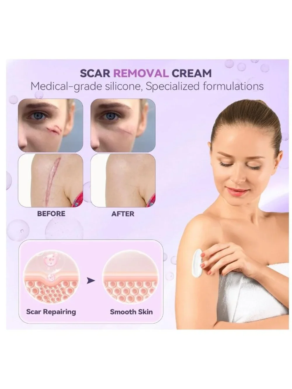 Silicone Scar Cream Removal Surgical Stretch Marks C-Section Keloid Injury Acne